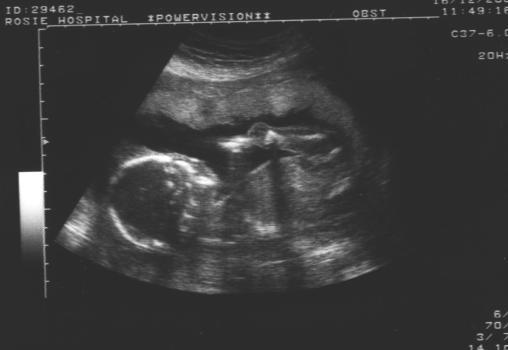 Scan