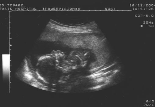 Scan