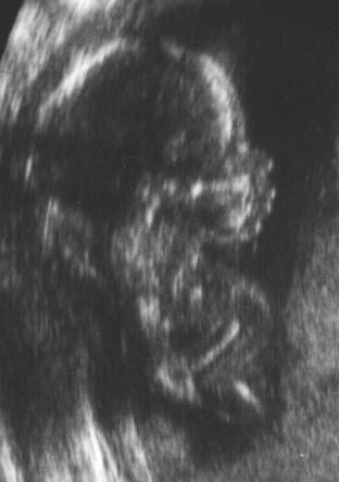 Scan