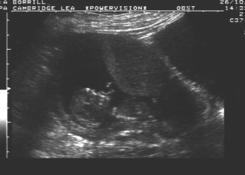 Scan