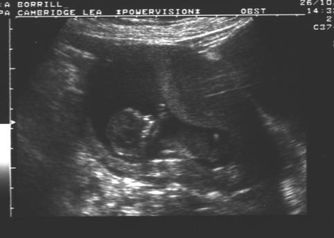 Scan